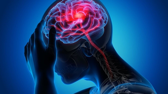 Chronische Migräne: „Nimm doch einfach eine Tablette“